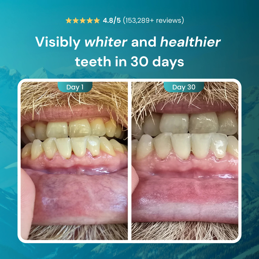 shinywhites® NOBS all-in-one tooth boost tablets